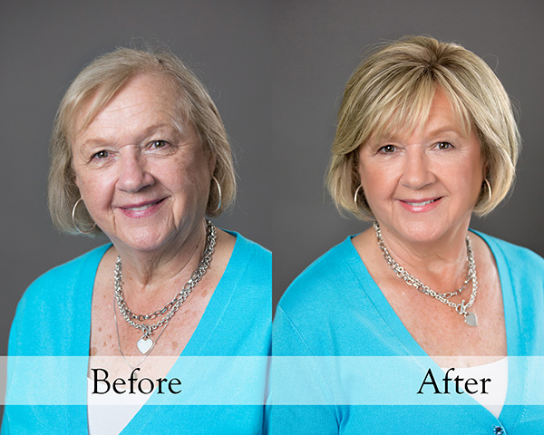 Non-Surgical Hair Replacement For Women – Styl-Rama